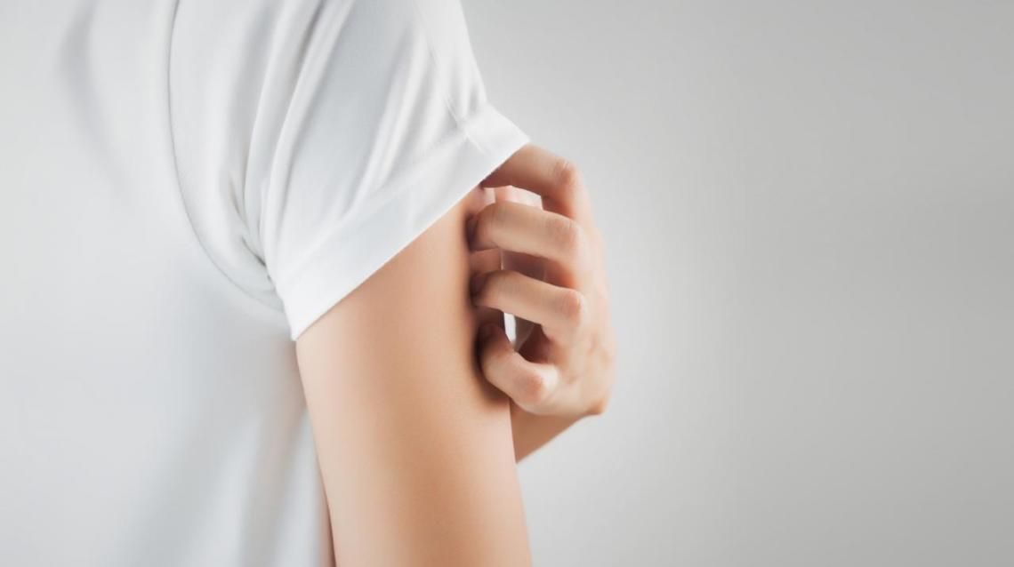 Etiology of Hives