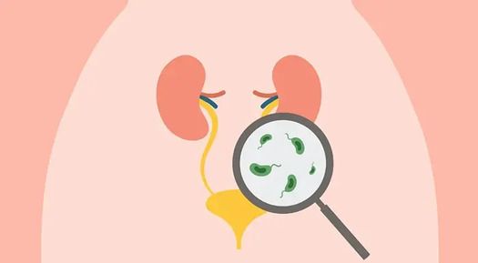 Recognizing the Signs: A Comprehensive Guide to Urinary Tract Infection Symptoms
